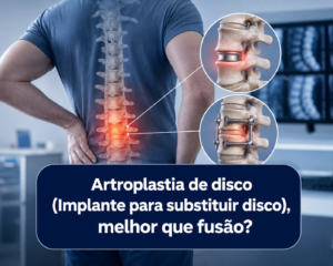 Artroplastia de disco