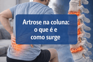 artrose da coluna