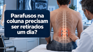 parafusos na coluna