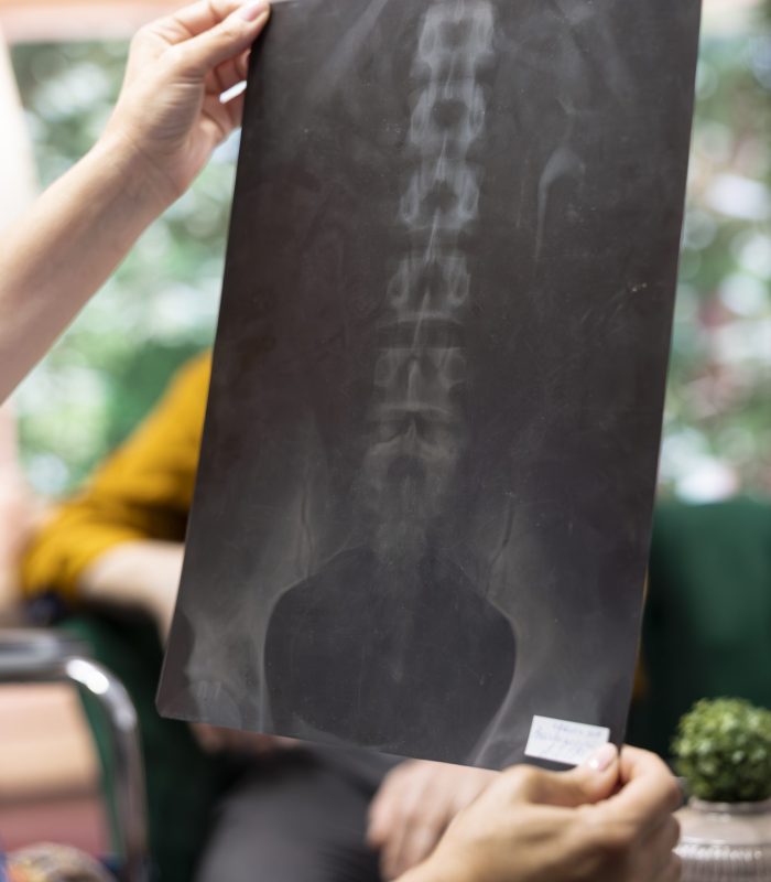 Medical caretaker presenting the x ray scan results and diagnosis, discussing about new health care treatment. Nurse showing the radiography to senior woman in wheelchair and husband. Close up.